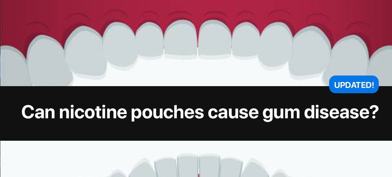 Can Nicotine Pouches Cause Gum Disease? Facts & Explanations